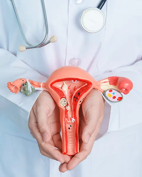 QUIRON | Endometriose